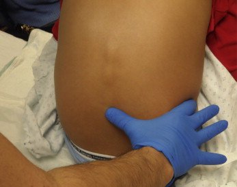 2/4/25: PEM Case of the Week