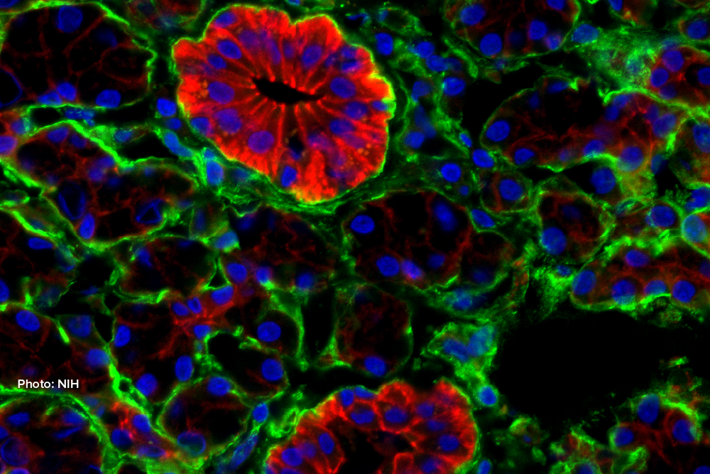 Understanding Regulation of Cell States and Fates